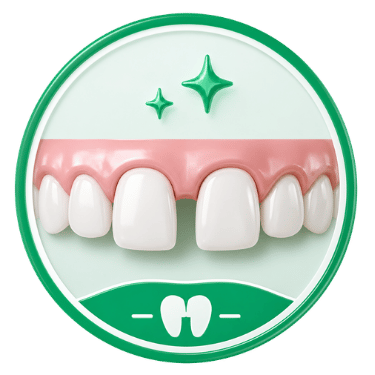 Composite Veneers